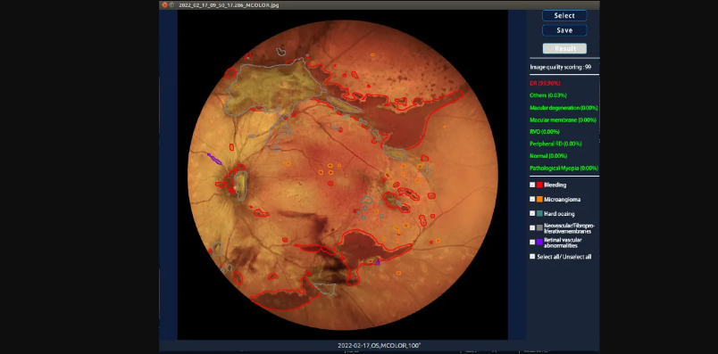 Ophthalmic Imaging