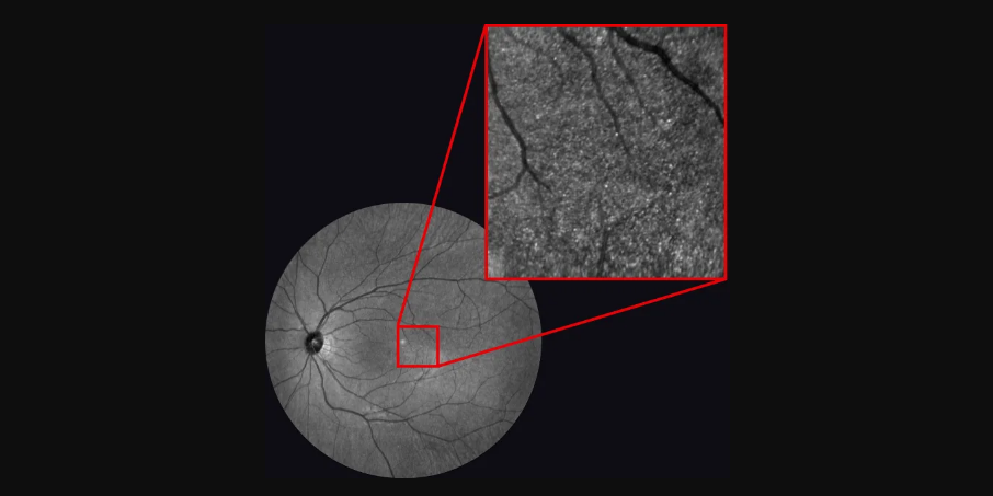 Ophthalmic Imaging