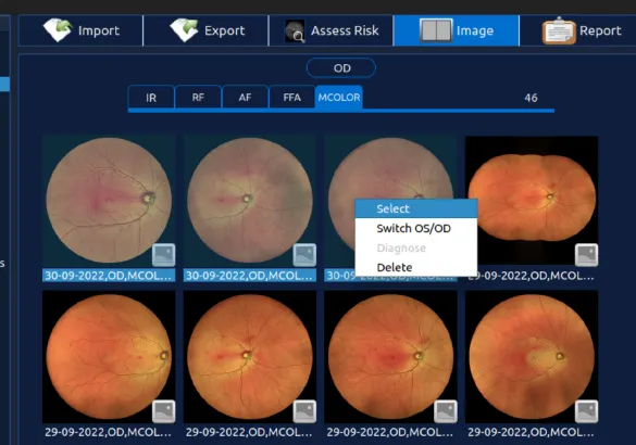 Image Quality Assessment