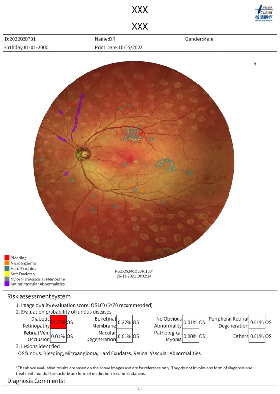 Probabilty score for 19 pathologies and features