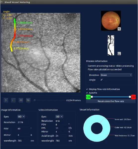 Measurement of the retina Blood Vessel