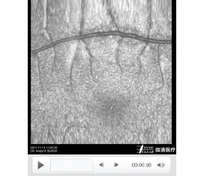 Cells and blood flow tools