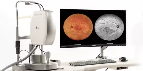 What is Retinal Imaging? Purpose, Procedure, Risks, Resutls