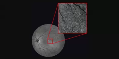 What is Ophthalmic Imaging?