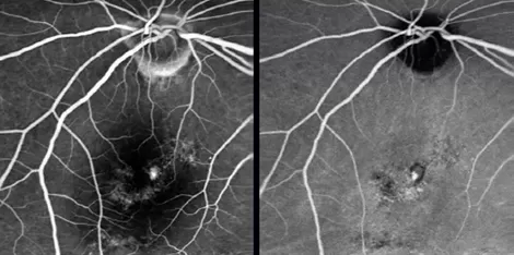 What is the difference between OCT and fundus photography?