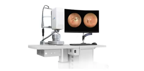 What is Wide Field Fundus Photography?